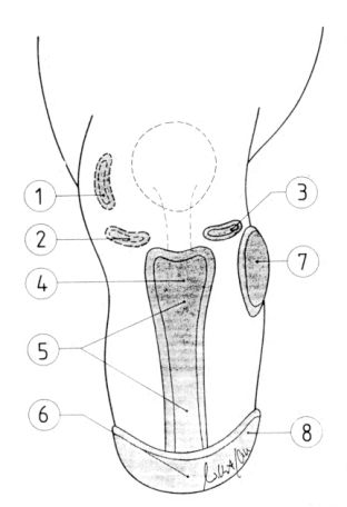 Reliet pad for bony landmarks