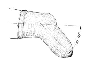 Heat protection and working position