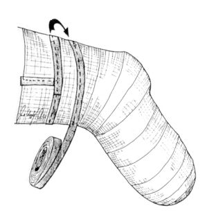 Heat protection with medical gauze