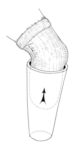 First applications of liner cone