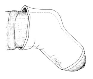 chamfering of lower cone end