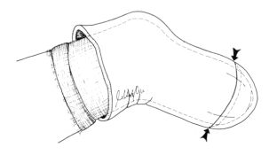 Appearance of closure cup completed