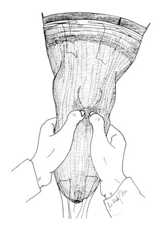 Checking of palpable contours